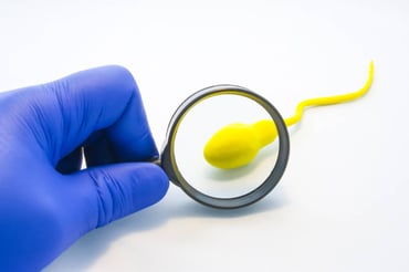 Mitos que vinculan la vasectomía y cáncer de próstata